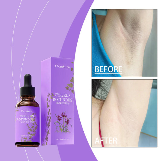 Post-hair removal repair serum bottle with purple box; before/after skin inset