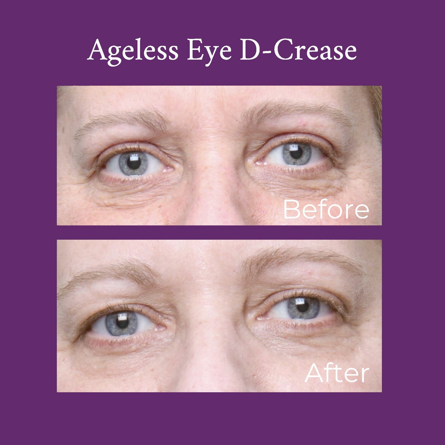 Ageless Eye D-Crease - Renee Lane Company