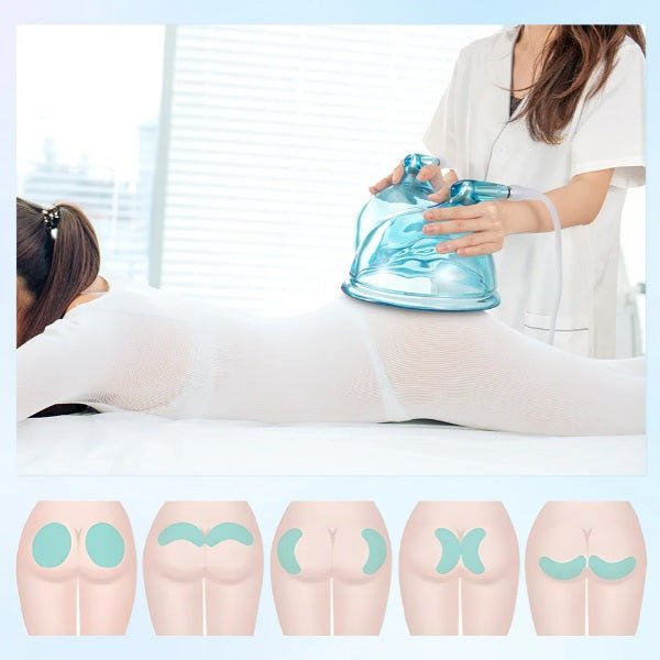 Shape Tactics 21cm Vacuum BBL Suction Therapy Cups - Renee Lane Company
