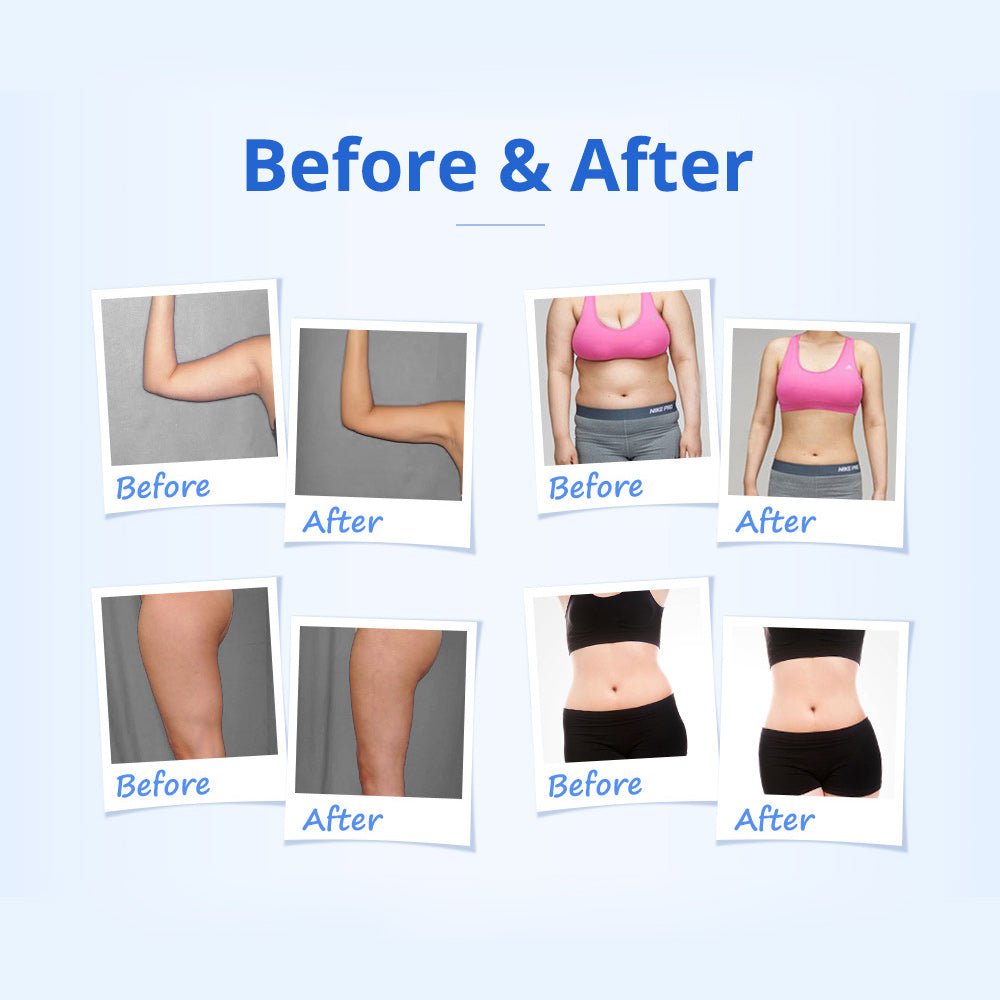 Shape Tactics 5-in-1 RF & 40K Cavitation Contouring System - Renee Lane Company