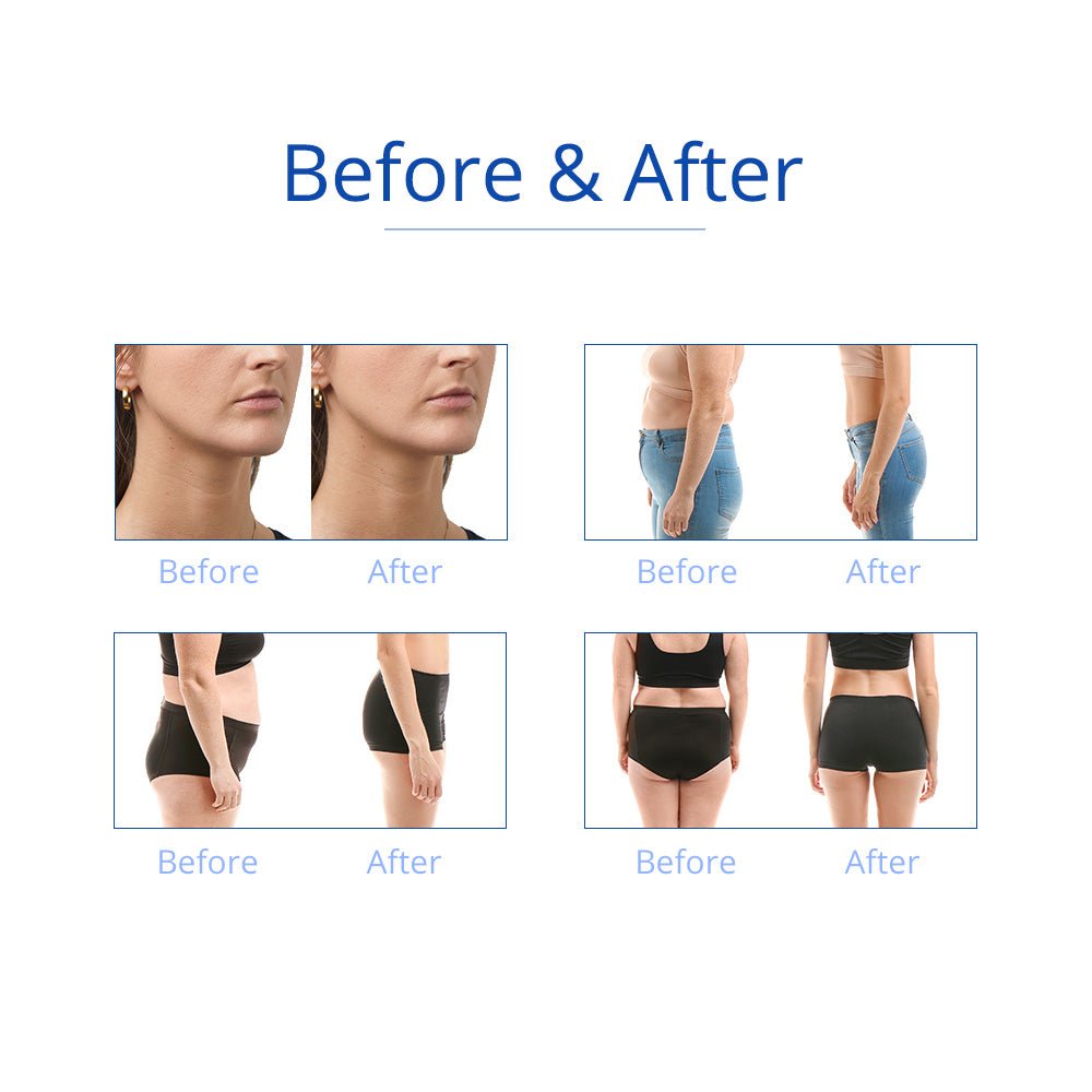 Shape Tactics 6-in-1 Cavitation RF Cryolipolysis Lipo Laser System - Renee Lane Company