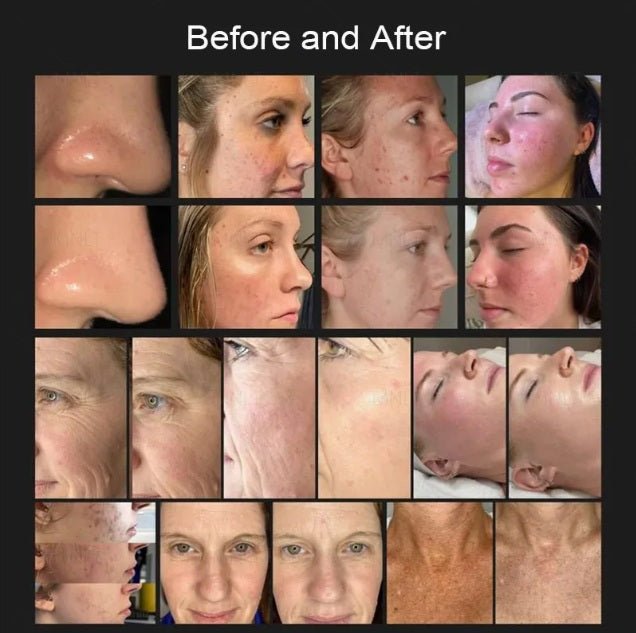 Shape Tactics 8-in-1 Hot & Cold Fusion Plasma Facial Beauty System - Renee Lane Company