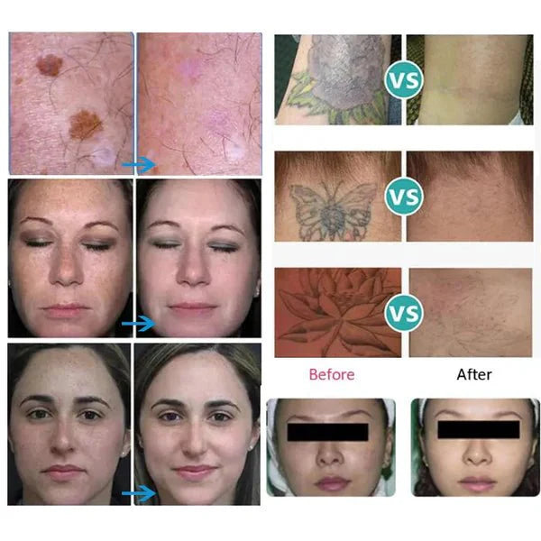 Shape Tactics Advanced Multi-Wavelength Picosecond Laser System - Renee Lane Company