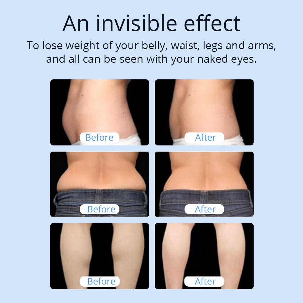 Shape Tactics CaVstorm Cavitation RF System - Renee Lane Company