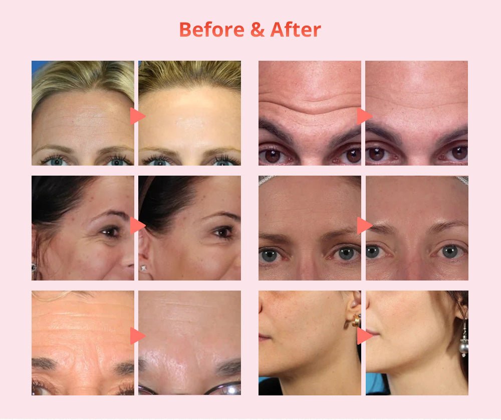 Shape Tactics Diamond Dermabrasion & Ultrasonic Skin Care System - Renee Lane Company
