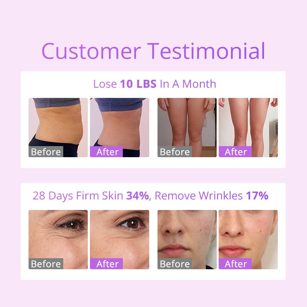 Shape Tactics S-Shape 30K Cavitation LED Laser System - Renee Lane Company