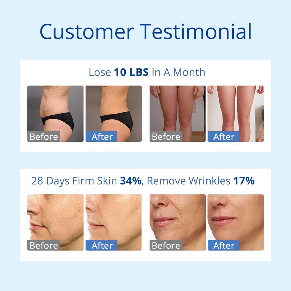 Shape Tactics S-Shape 30K Cavitation RF & 160mW Lipo Laser System - Renee Lane Company