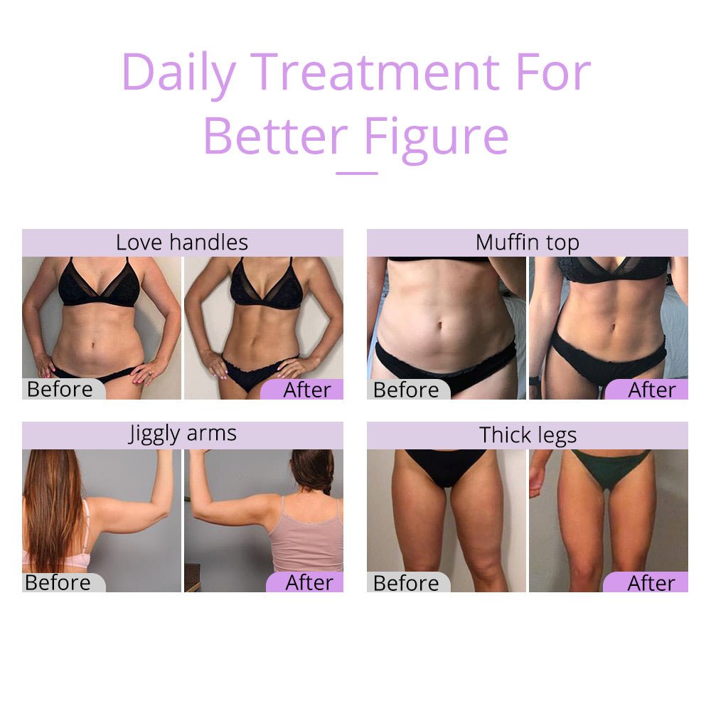 Shape Tactics Unoisetion 2.5 Ultrasonic Cavitation System - Renee Lane Company