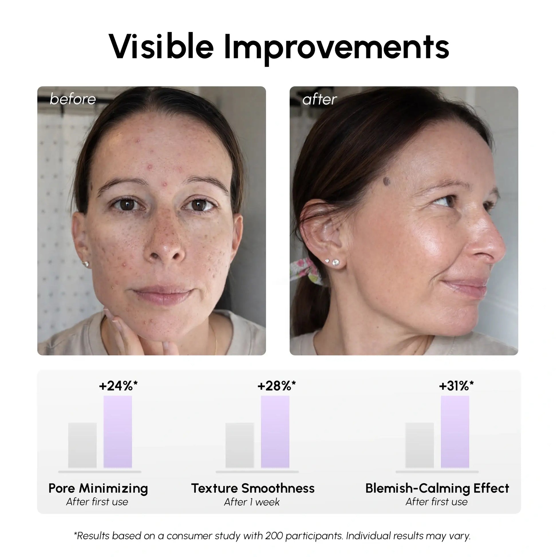 12% Niacinamide Smooth & Glow Pads - Renee Lane Company