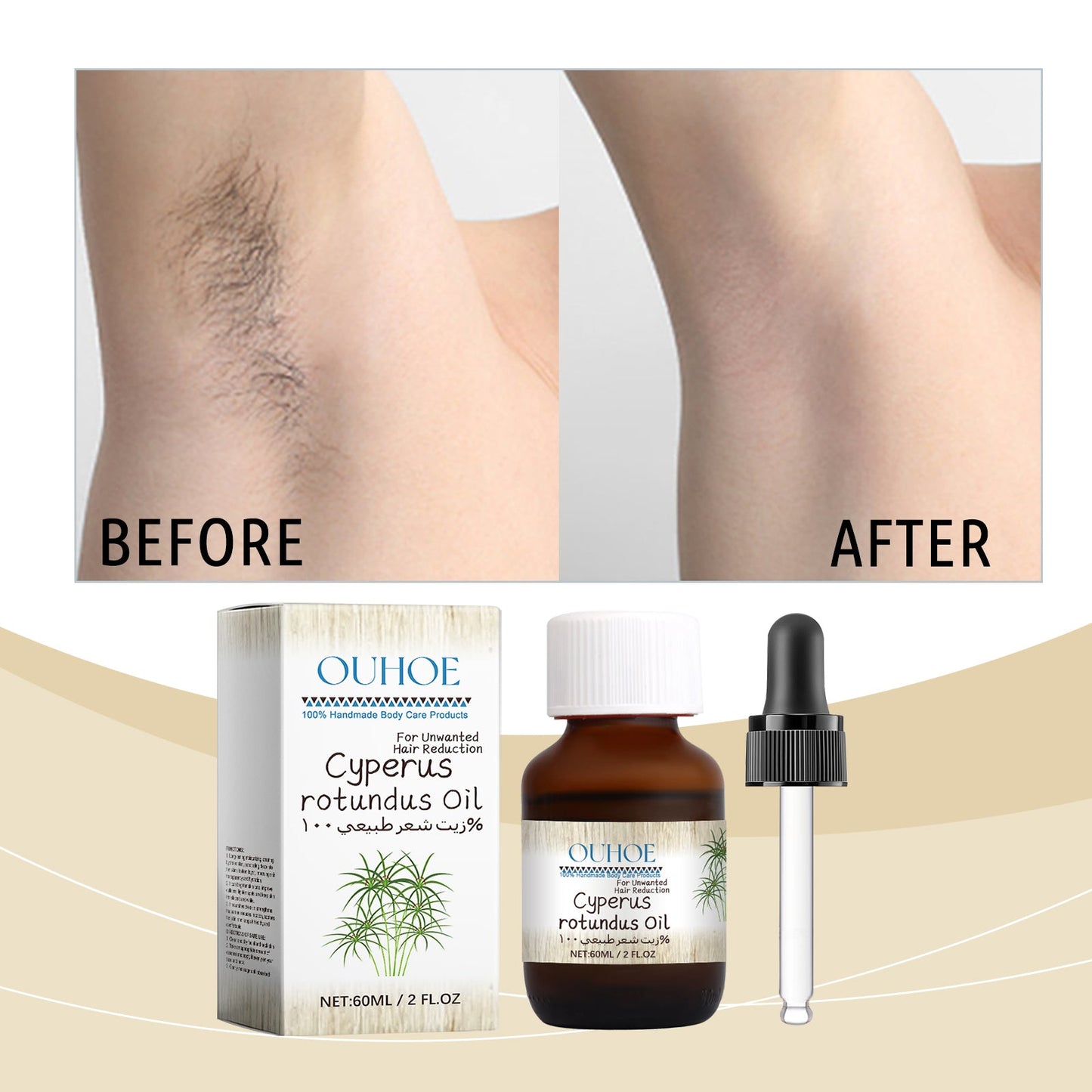 OUHOE Cyperus hair removal care oil set with dropper and box