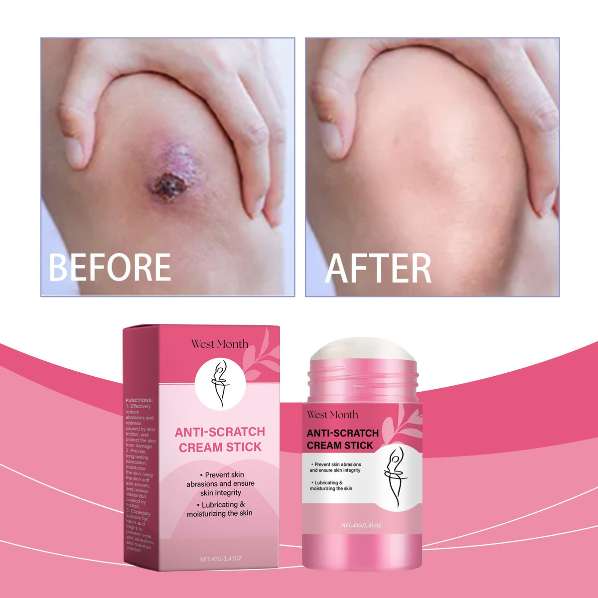 Body Anti Scratch Moisturizing Stick 40g 1 Box