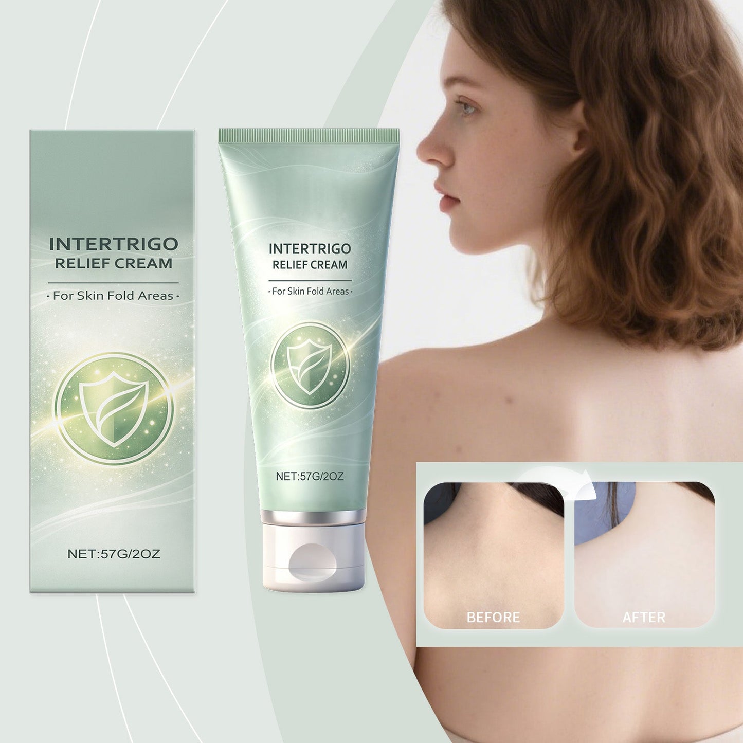Intertrigo relief cream tube and box with person profile and before-and-after inset
