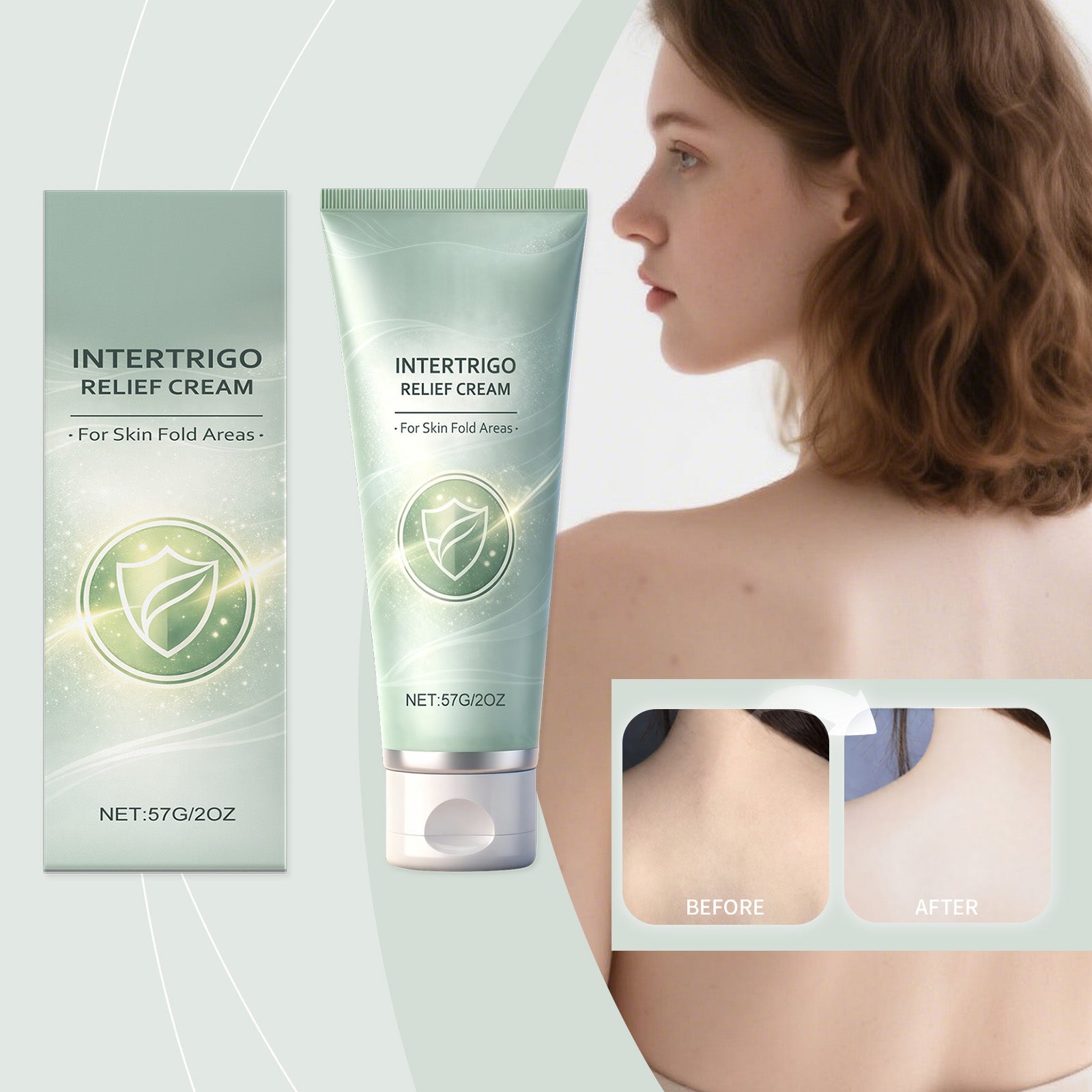 Intertrigo relief cream tube and box with person profile and before-and-after inset