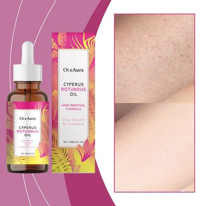 Hair Removal Soothing Essential Oil 30ml
