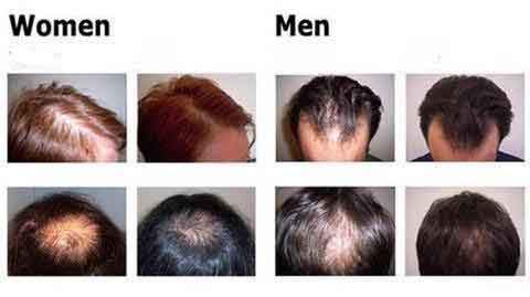 Hair growth essence results grid with scalp photos labeled Women and Men