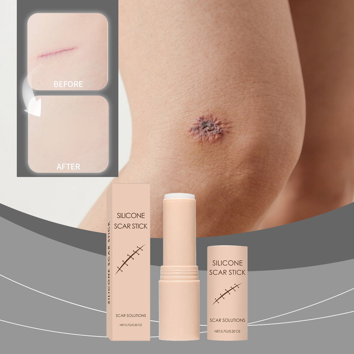 Scar Gentle Care Stick