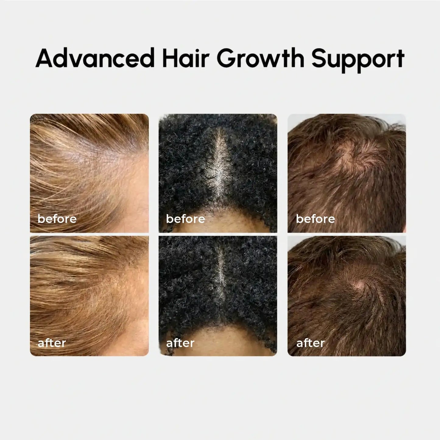 4-in-1 Hair Growth Spray - Renee Lane Company