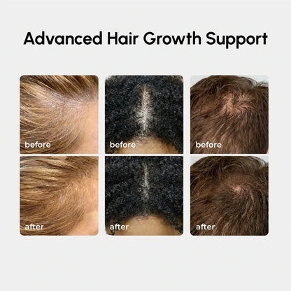 4-in-1 Hair Growth Spray - Renee Lane Company