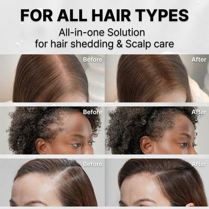Hair Care With Built-in Brush Head