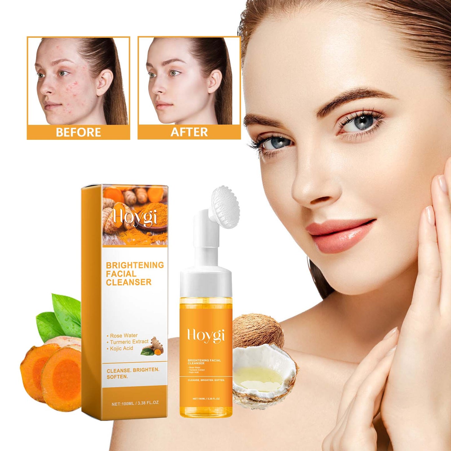 Facial cleanser bottle and box with white pump; before and after skin panels