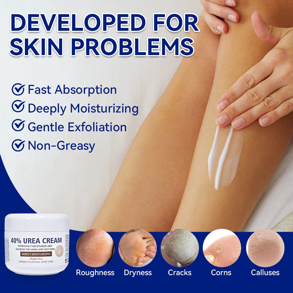Urea cream for skin problems infographic with legs and application jar