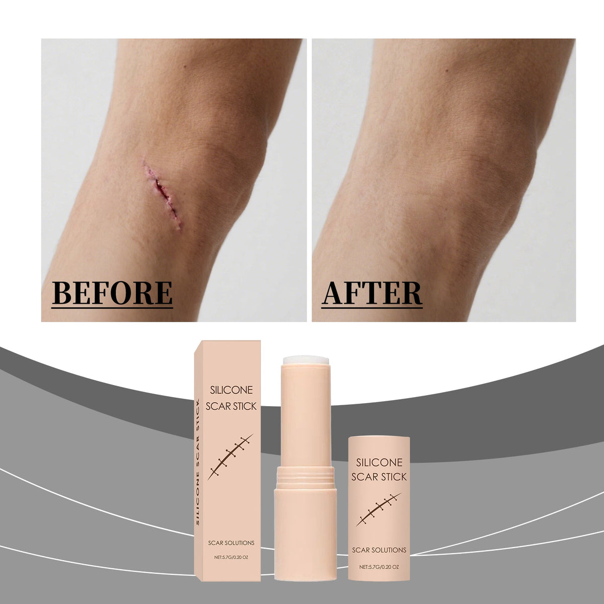 Scar Gentle Care Stick