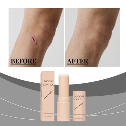 Scar Gentle Care Stick
