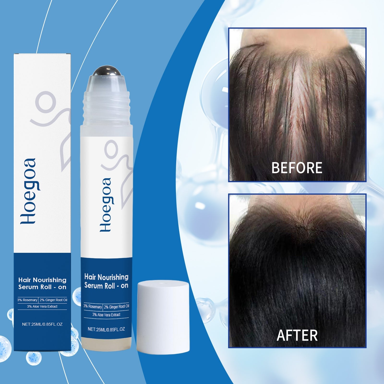 Hair growth roll-on serum bottle with white box and before/after scalp panels