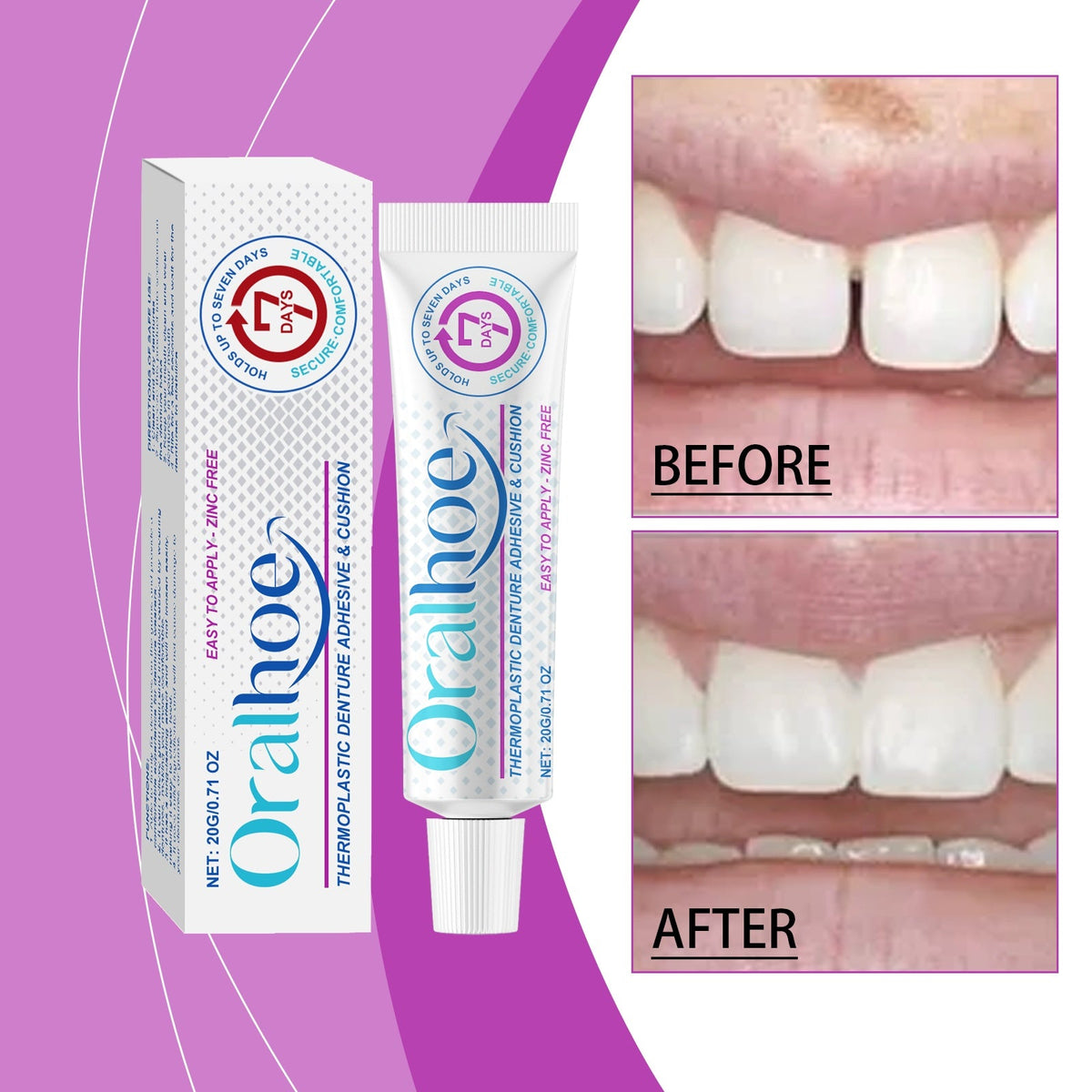 Denture Adhesive 20g