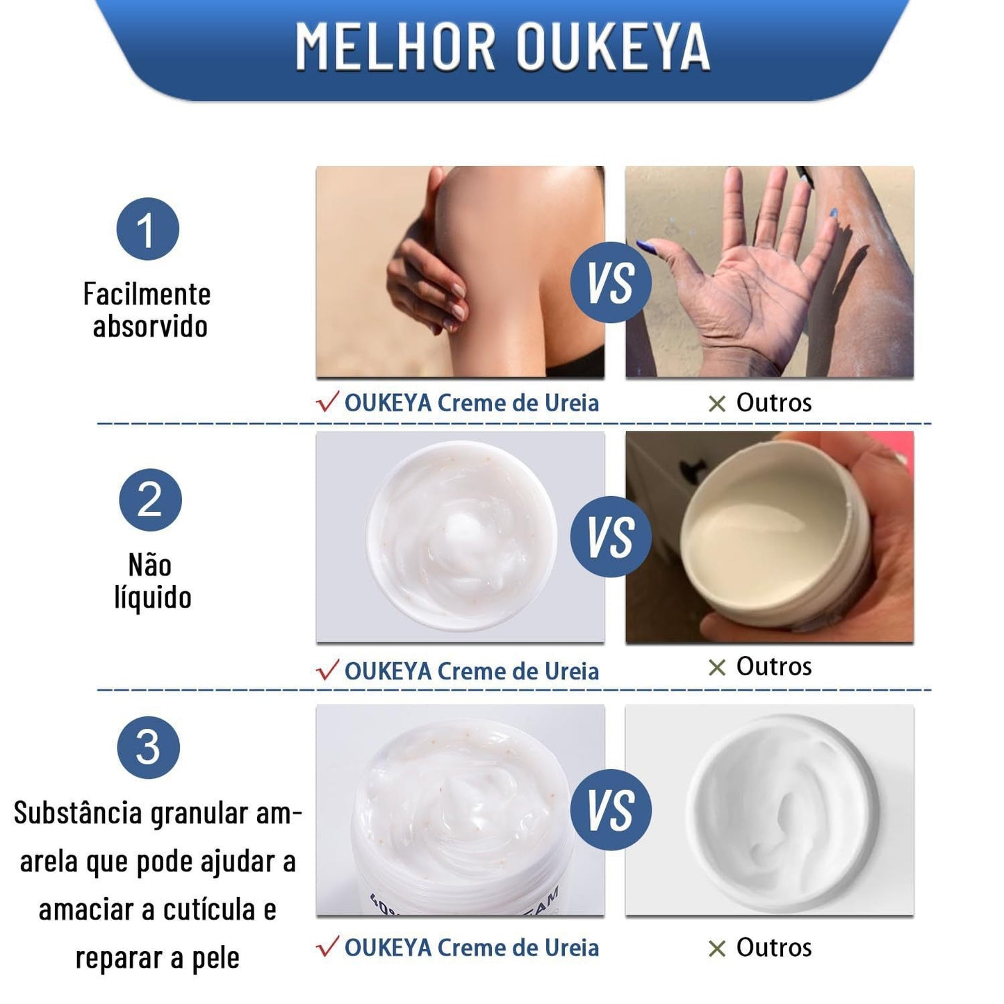 Urea cream comparison infographic with moisturizer jar shown beside chart