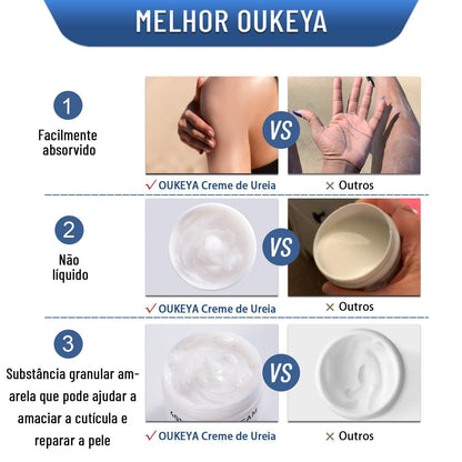 Urea cream comparison infographic with moisturizer jar shown beside chart