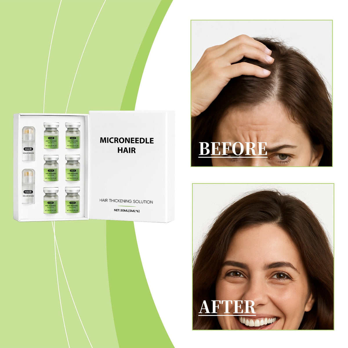 Dense Micro-Needle Roller Serum 5mlx6pcs