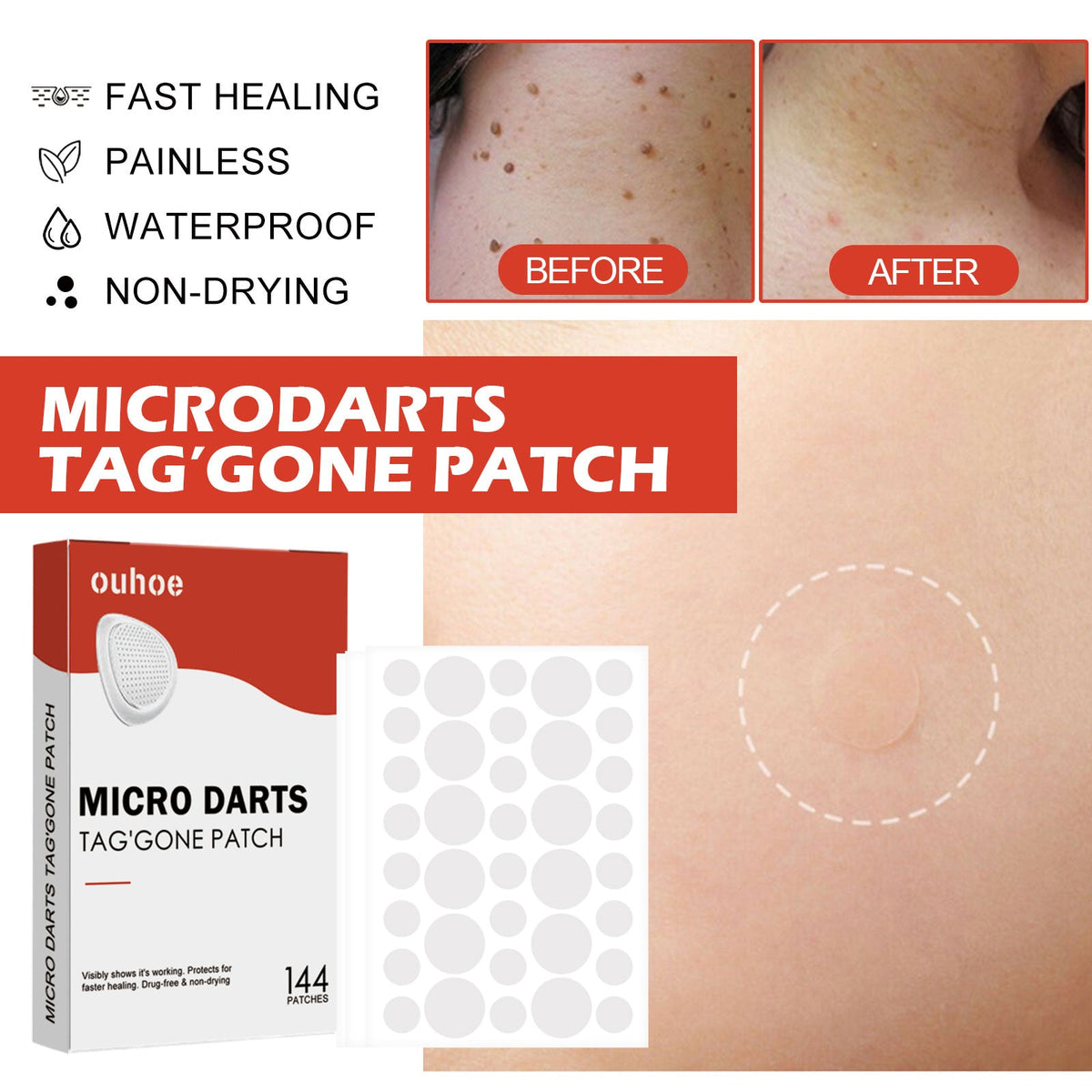 Purifying Face Patches 144PCS