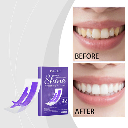 Teeth whitening patches box with before/after smile panels and purple “30” graphics