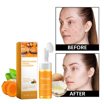 Facial cleanser bottle with white pump and boxed cleanser beside before/after portraits