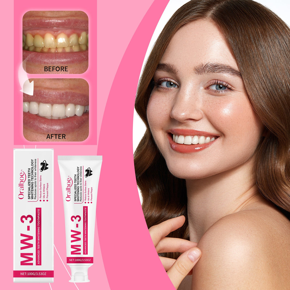 Whitening toothpaste box and tube with smiling woman and small dental before/after inset