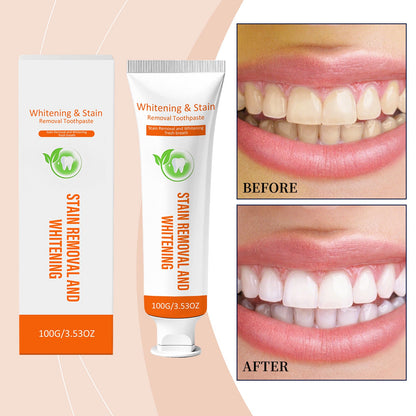 Gentle Whitening Toothpaste 1 00g  1box