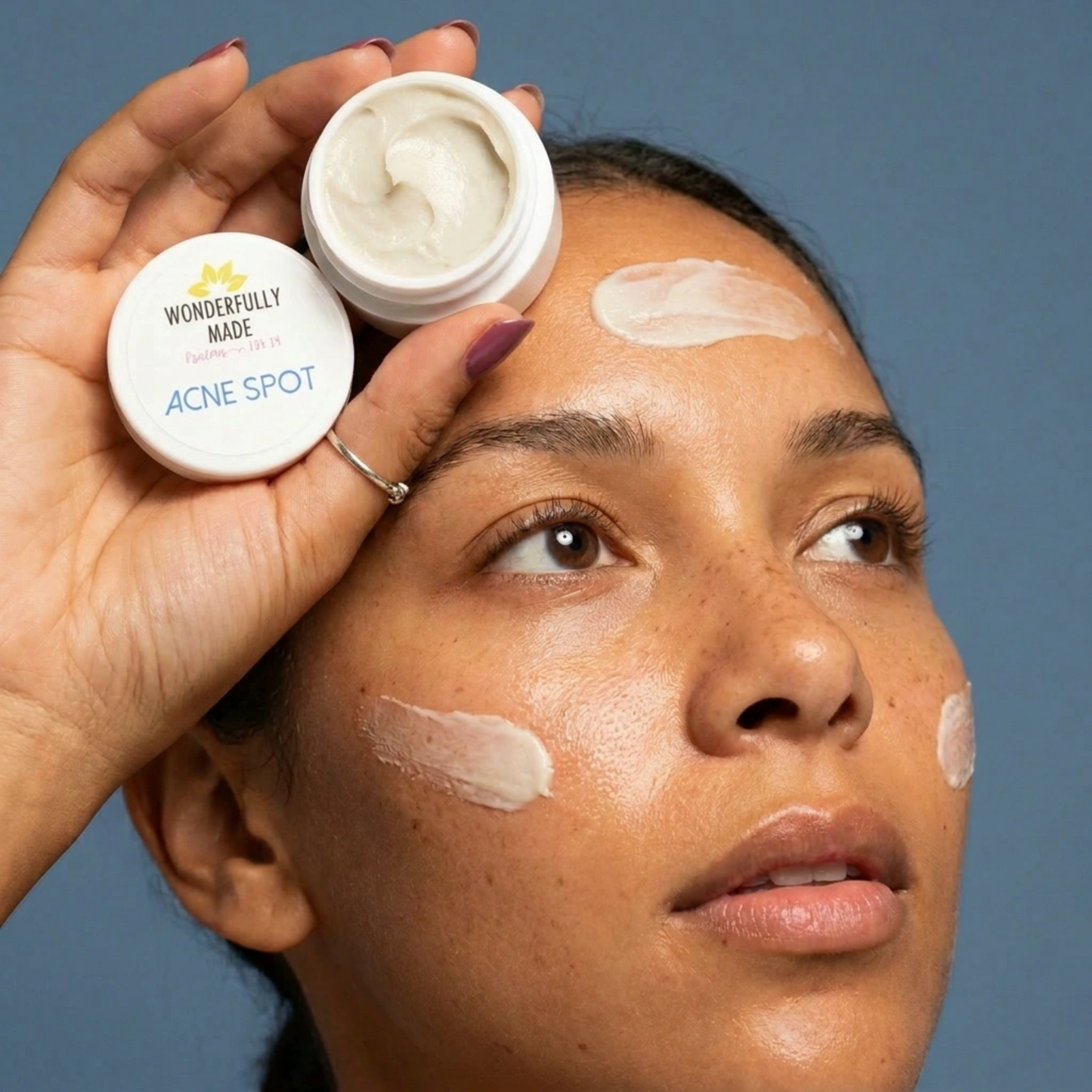Acne Spot Treatment | Blemish Banish | Pimple Erase - Renee Lane Company