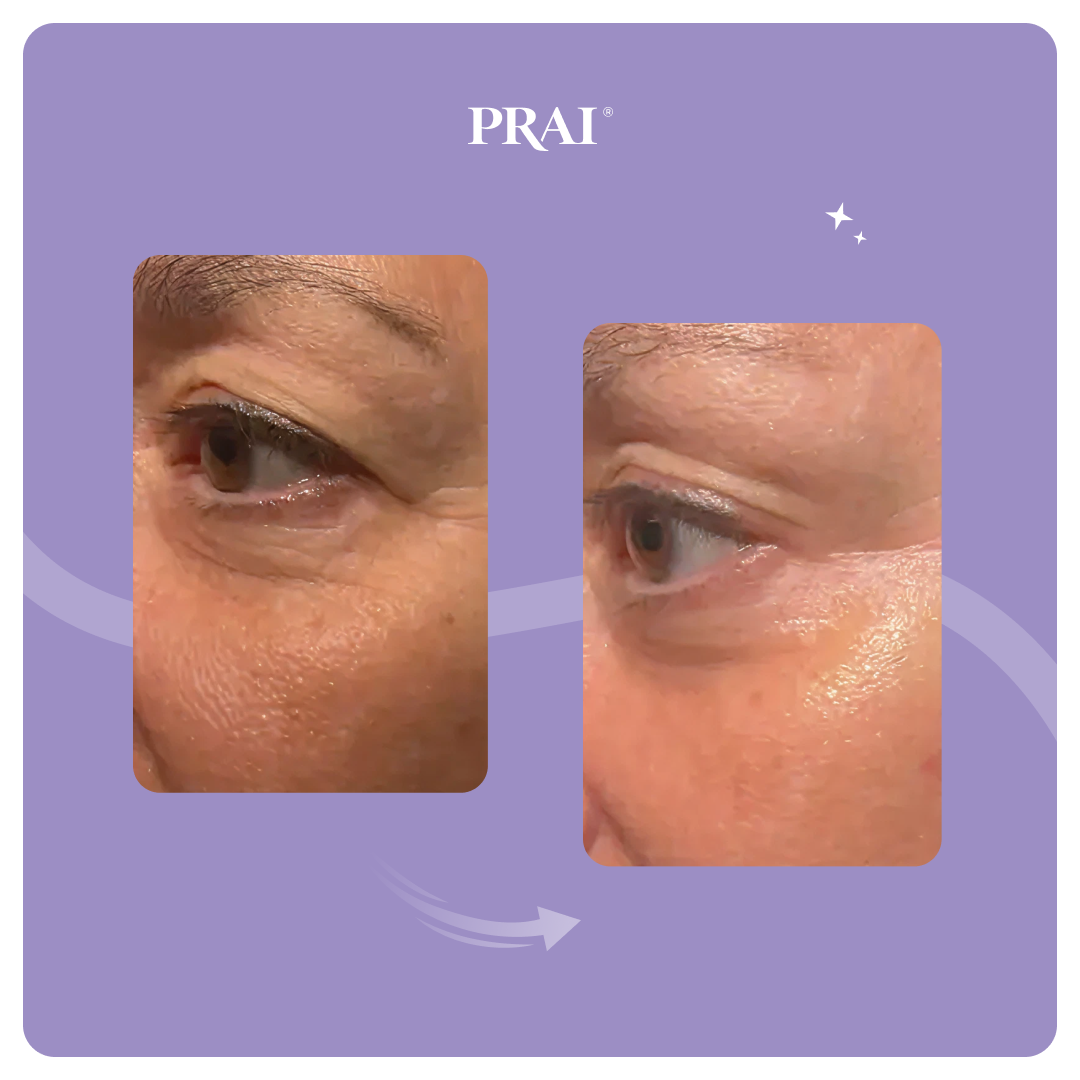 Ageless Eye Tight Uplift Serum - Renee Lane Company