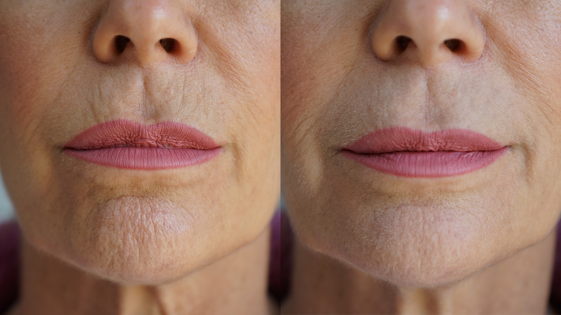 Ageless Lip & Line Filler - Renee Lane Company