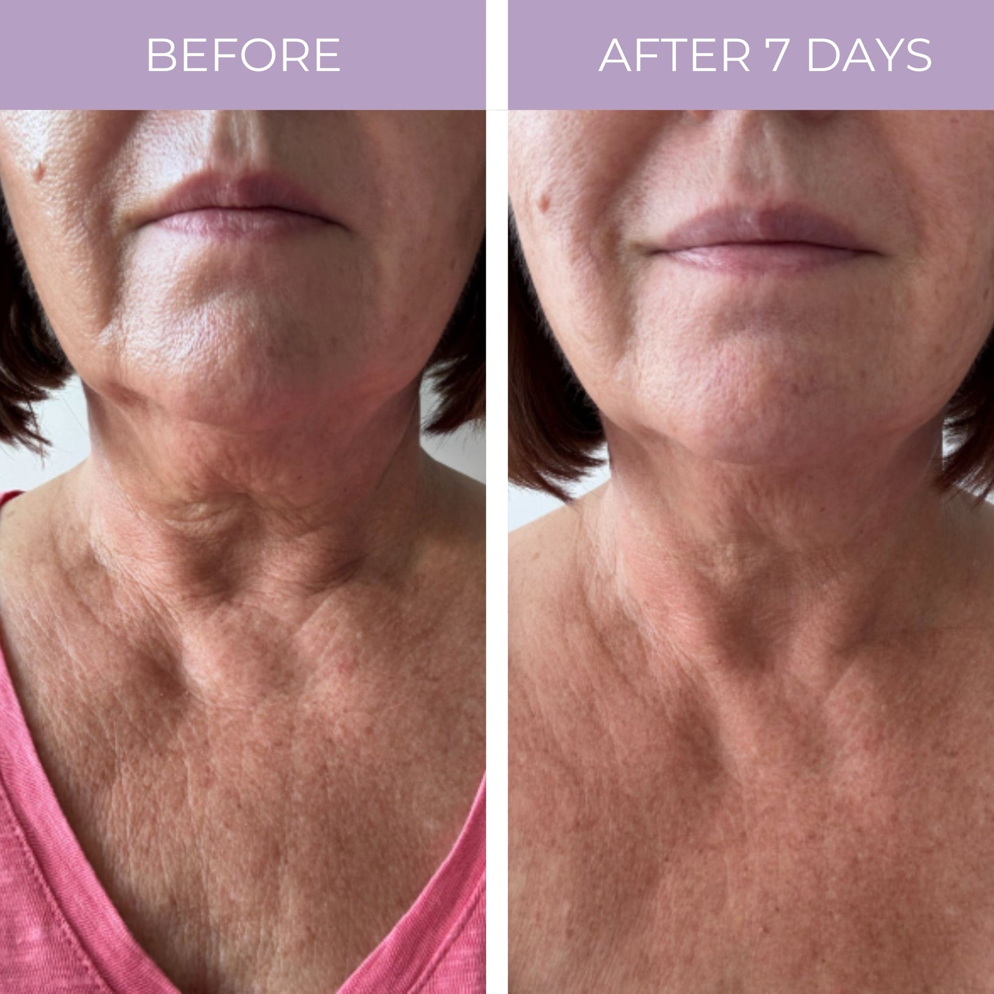 Ageless Throat & Decolletage Anti-Aging Neck Creme - Renee Lane Company