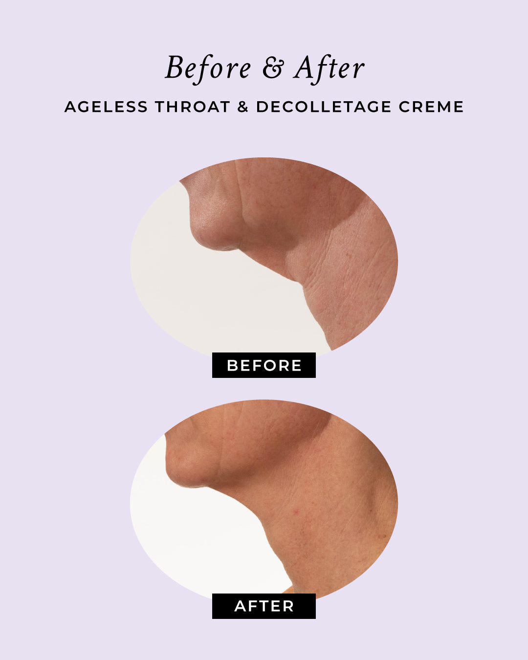 Ageless Throat & Decolletage Anti-Aging Neck Creme - Renee Lane Company