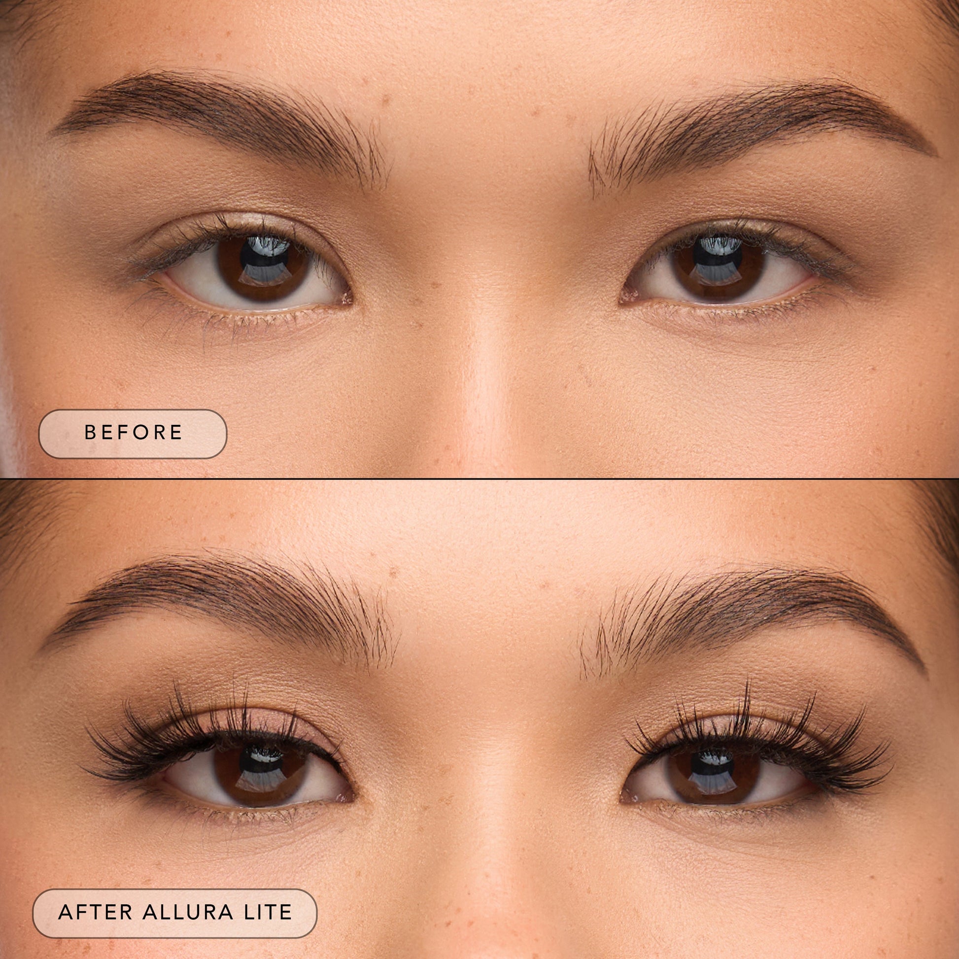 Allura Lite® - Renee Lane Company