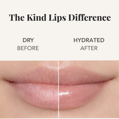 Before-and-after lips split showing dry before and hydrated after for lip balm