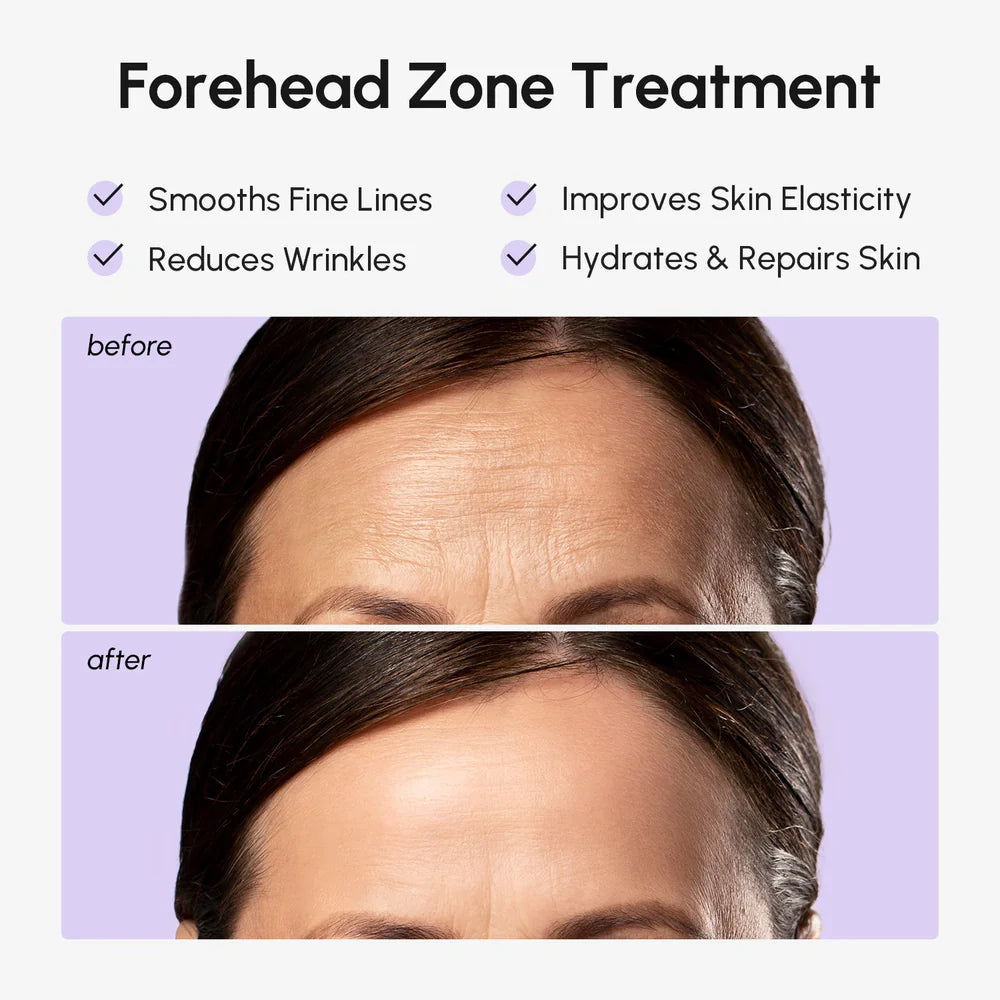 Anti-Wrinkle Forehead Patches - Renee Lane Company