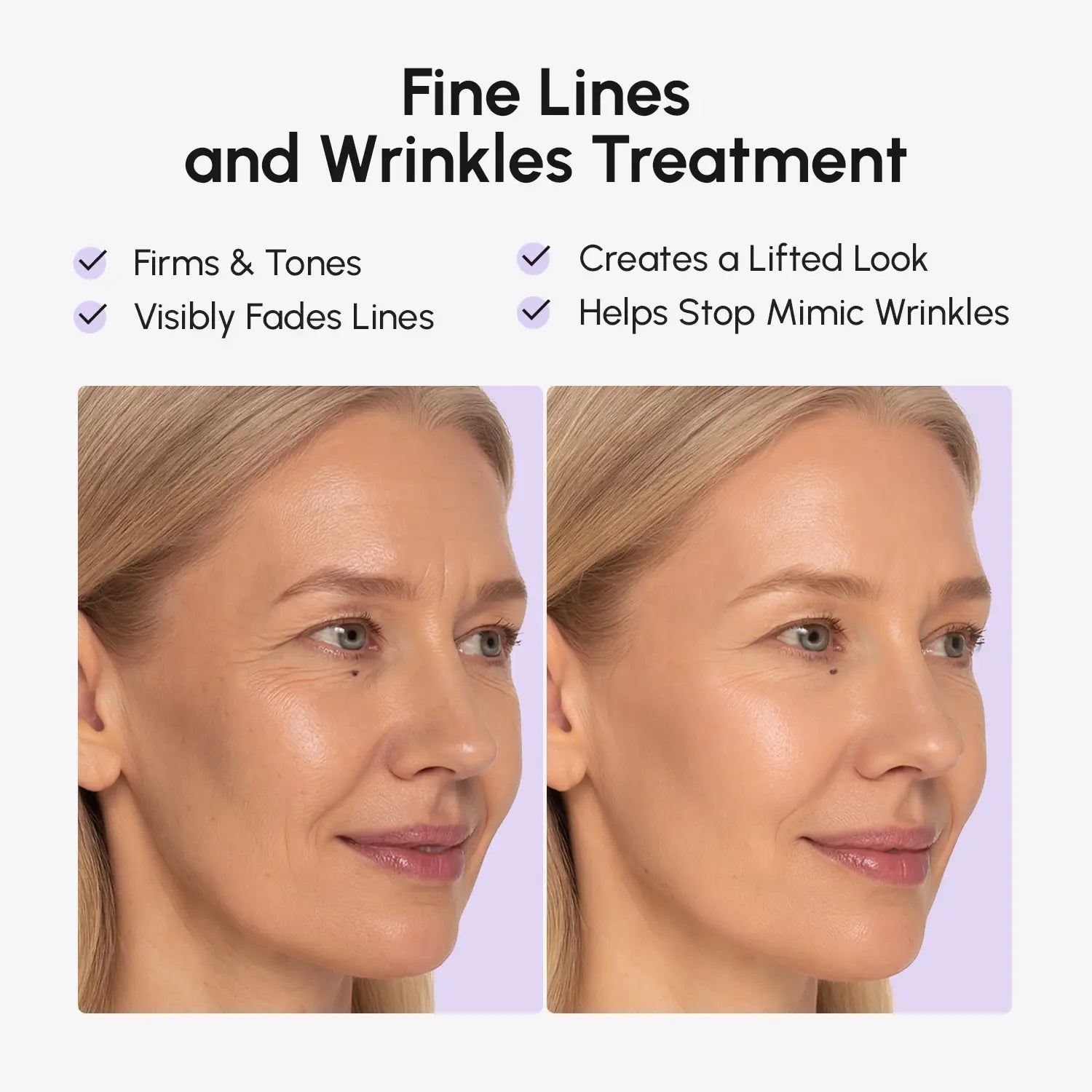 Anti-wrinkle Tape Patches - Renee Lane Company