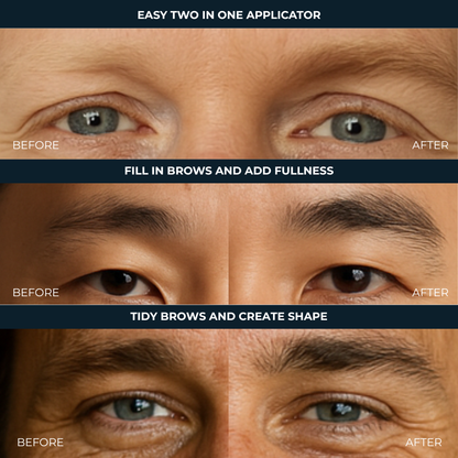 Brow Rescue