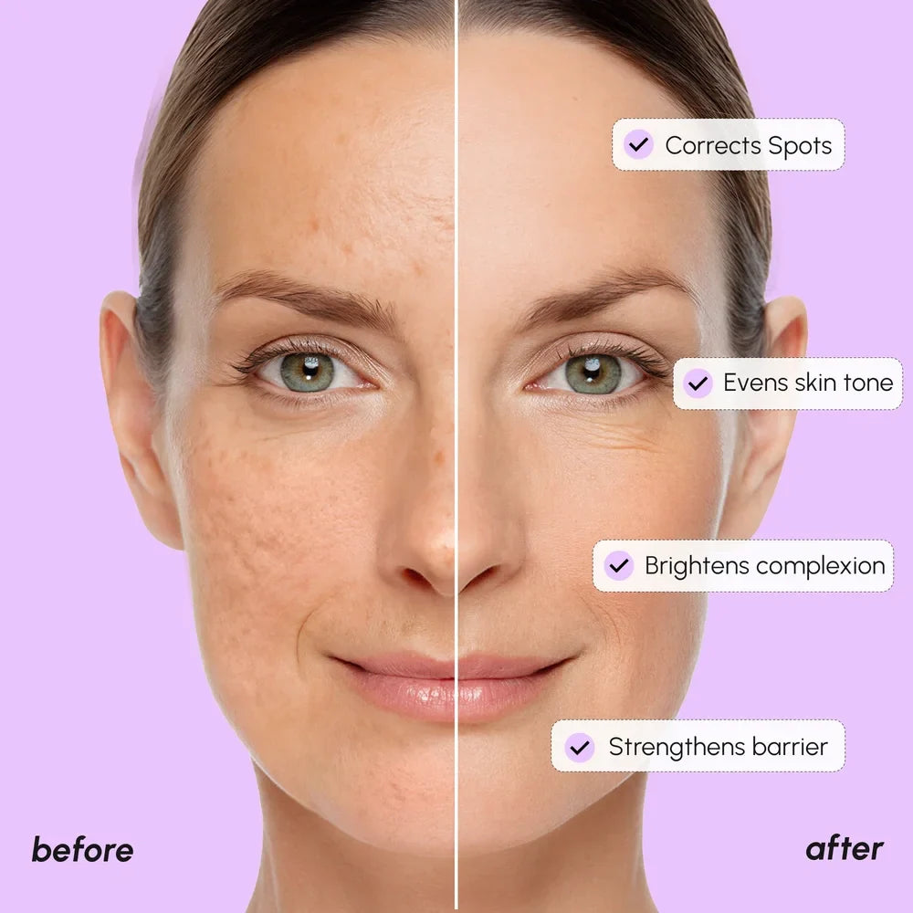 Dark Spot Corrector - Renee Lane Company