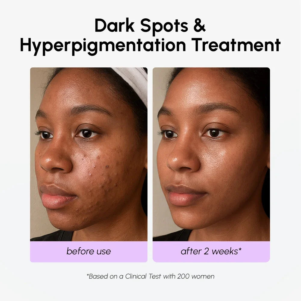 Dark Spot Corrector - Renee Lane Company