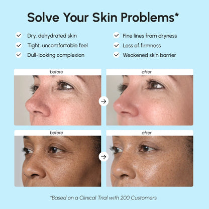 Deep Moisture Collagen Face Cream - Renee Lane Company